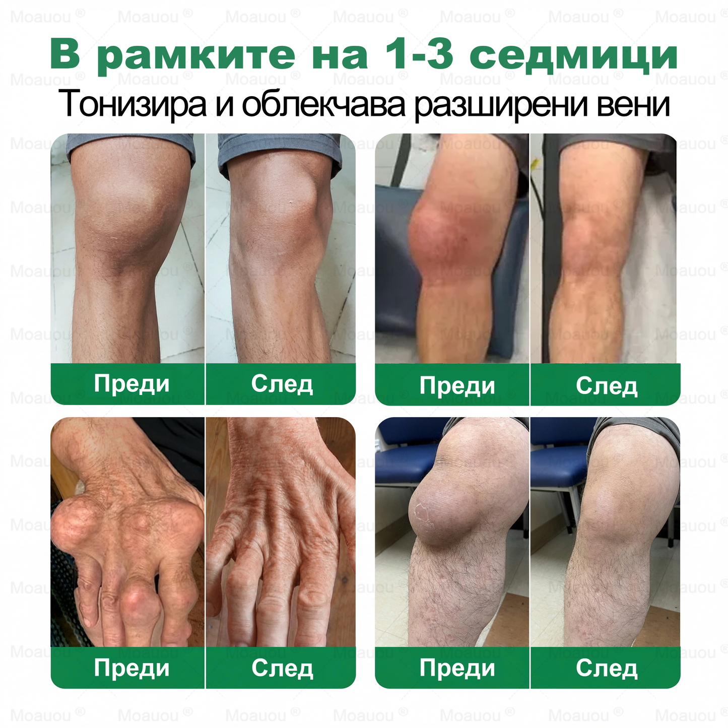 🇧🇬👨‍⚕️✅✅ Moauou® Крем за вени и стави – целенасочено действие ⚡ Мигновено облекчение, дълготрайни резултати | Голяма разпродажба!