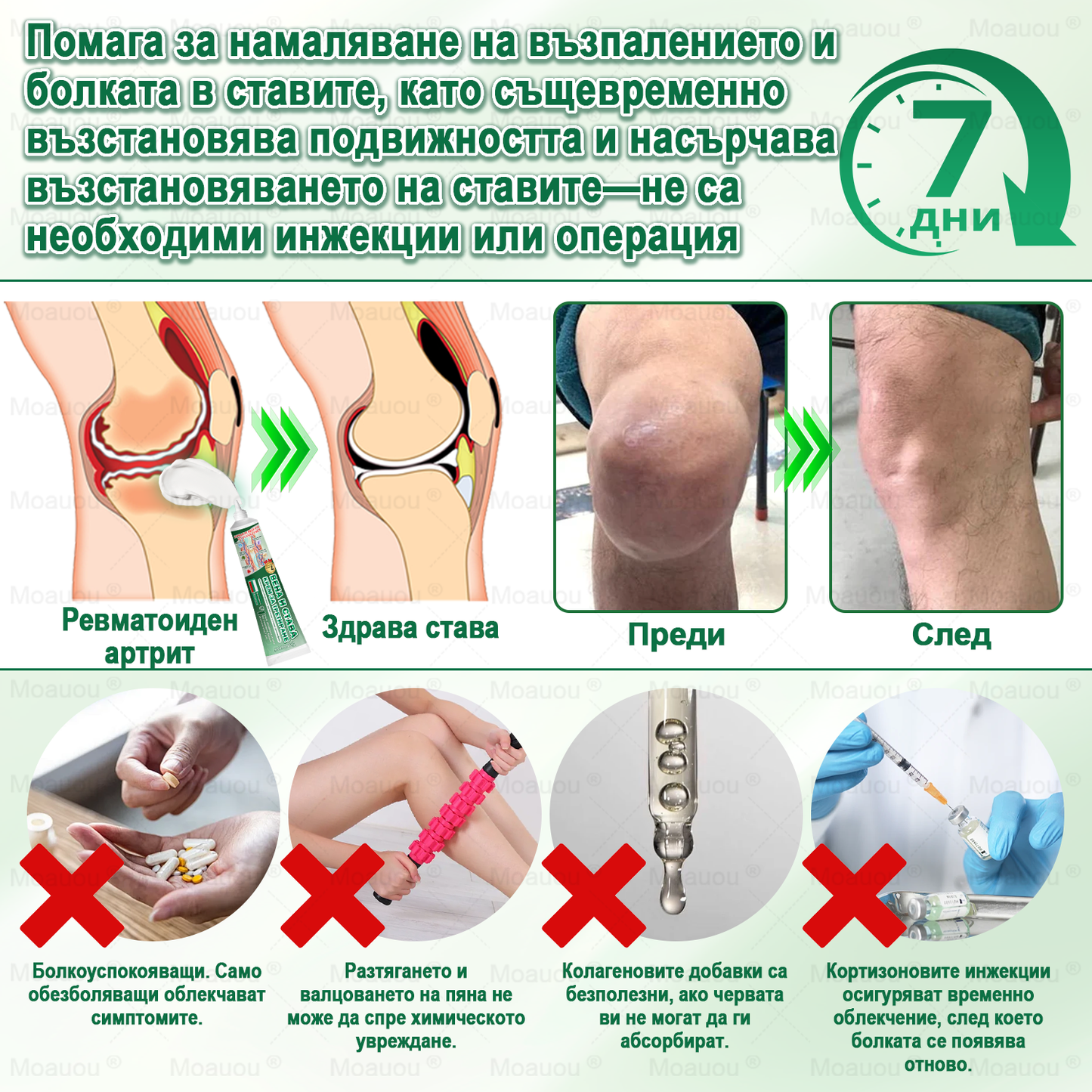 🇧🇬👨‍⚕️✅✅ Moauou® Крем за вени и стави – целенасочено действие ⚡ Мигновено облекчение, дълготрайни резултати | Голяма разпродажба!
