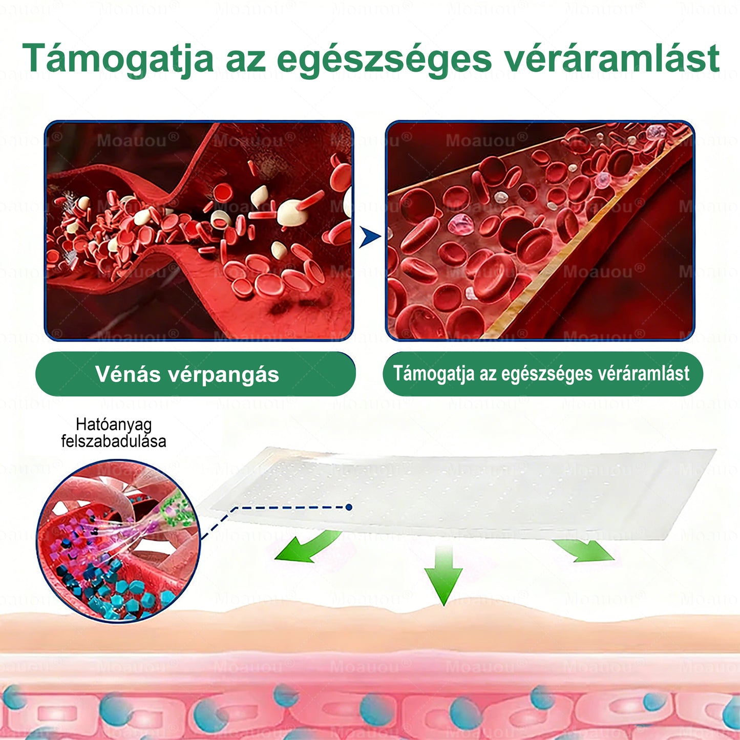 Moauou® Ércélzó Mikrotűs Tapasz ⚡ Azonnali enyhülés, hosszan tartó eredmények – NAGY AKCIÓ!