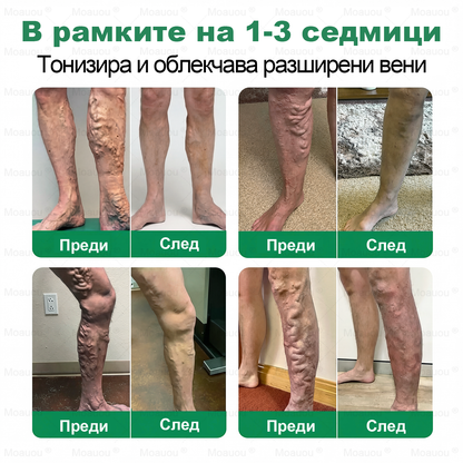 🇧🇬👨‍⚕️✅✅ Moauou® Крем за вени и стави – целенасочено действие ⚡ Мигновено облекчение, дълготрайни резултати | Голяма разпродажба!