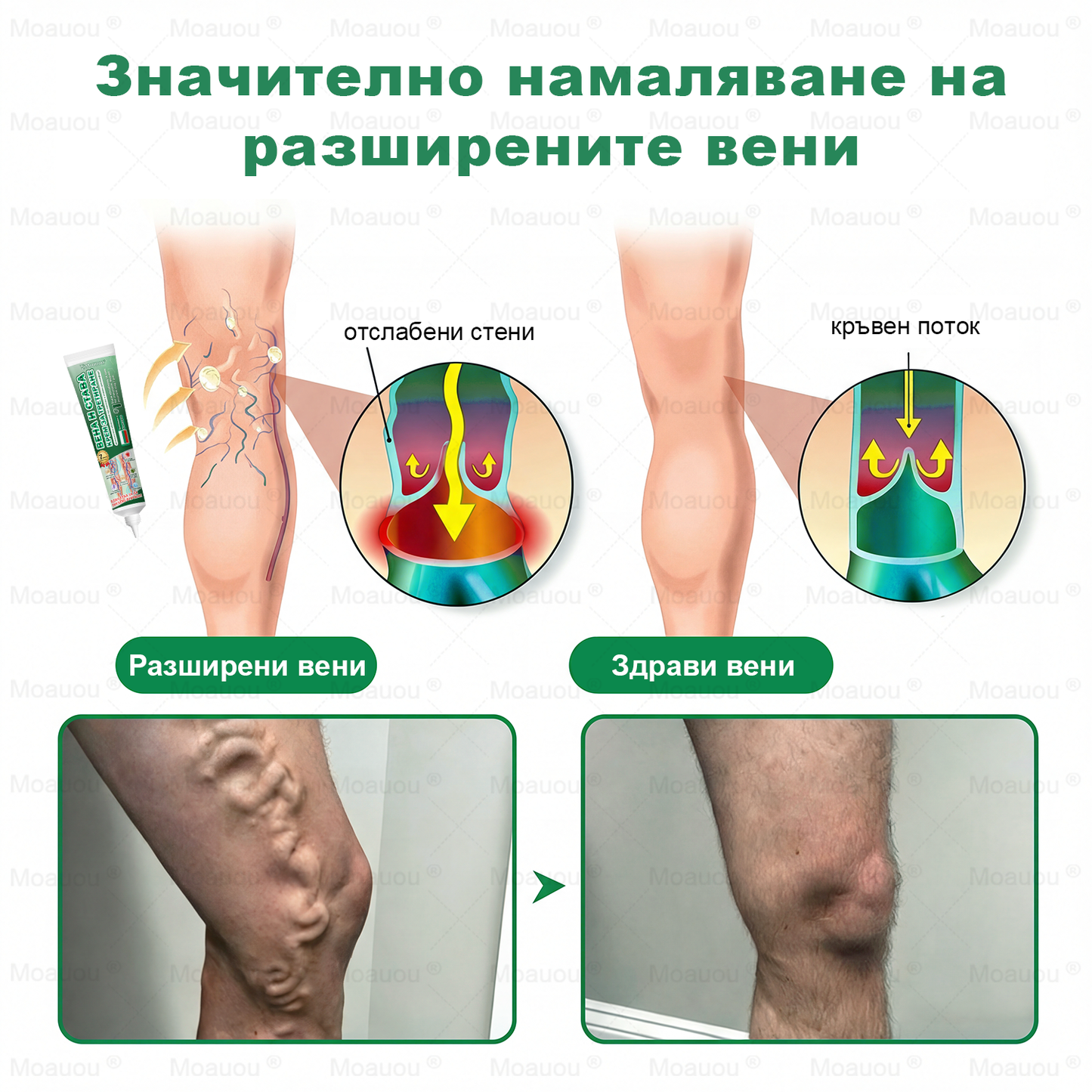 🇧🇬👨‍⚕️✅✅ Moauou® Крем за вени и стави – целенасочено действие ⚡ Мигновено облекчение, дълготрайни резултати | Голяма разпродажба!